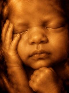 Ultrasound Baby photo style preview